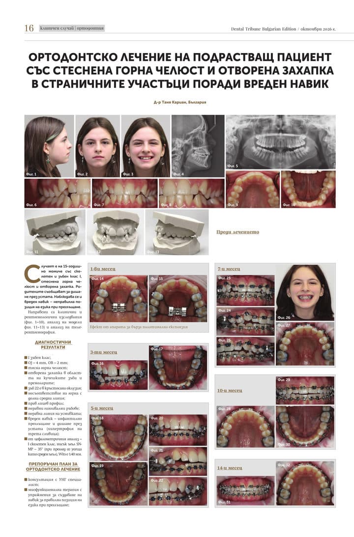Страница 16 от Dental Tribune Bulgarian Edition, октомври 2026, с клиничния случай на д-р Таня Кариан